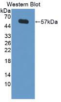 1 - Polyclonal Antibody to Lipopolysaccharide Binding Protein (LBP) AP74699