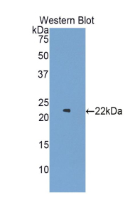 1 - Polyclonal Antibody to Colony Stimulating Factor Receptor, Granulocyte (GCSFR) AP74676