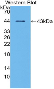 1 - Polyclonal Antibody to Matrix Gla Protein (MGP) AP74728