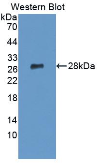 1 - Polyclonal Antibody to Lymphocyte Function Associated Antigen 1 Alpha (CD11a) AP74700