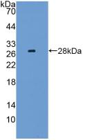 1 - Polyclonal Antibody to Lymphocyte Activation Gene 3 (LAG3) AP74682