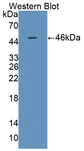 1 - Polyclonal Antibody to Interleukin 21 (IL21) AP74606