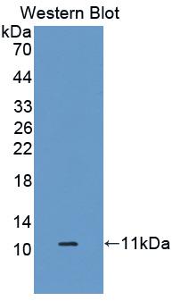 1 - Polyclonal Antibody to S100 Calcium Binding Protein A6 (S100A6) AP74632
