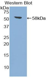 1 - Polyclonal Antibody to Transglutaminase 1 (TGM1) AP74662