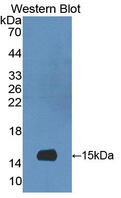 1 - Polyclonal Antibody to S100 Calcium Binding Protein A9 (S100A9) AP74607
