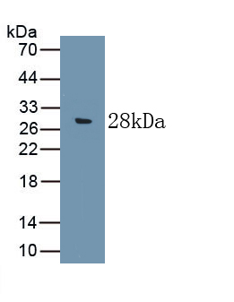 1 - Polyclonal Antibody to Complement Component 9 (C9) AP74608