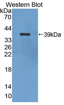 1 - Polyclonal Antibody to Nuclear Factor Kappa B2 (NFkB2) AP74730