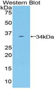 1 - Polyclonal Antibody to Frizzled Homolog 10 (FZD10) AP74681