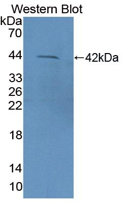 1 - Polyclonal Antibody to Cluster Of Differentiation 3d (CD3d) AP74731