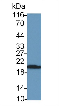 1 - Polyclonal Antibody to Cluster Of Differentiation 3d (CD3d) AP74633