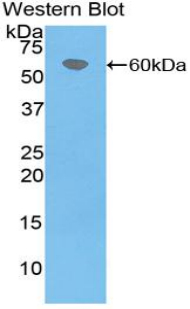 1 - Polyclonal Antibody to Coagulation Factor VII (F7) AP74658