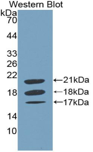 1 - Polyclonal Antibody to Coagulation Factor VIII (F8) AP74659