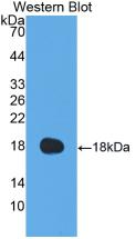 1 - Polyclonal Antibody to Coagulation Factor VIII (F8) AP74666