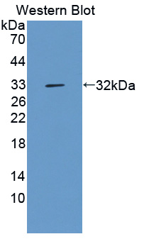 1 - Polyclonal Antibody to Aggrecan (AGC) AP74732