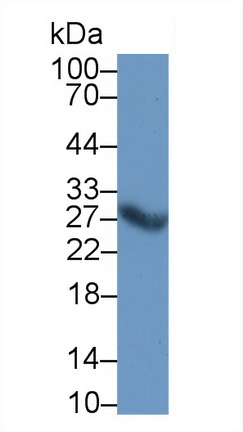 1 - Polyclonal Antibody to Cathepsin S (CTSS) AP74702
