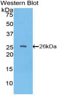 1 - Polyclonal Antibody to Tissue Factor Pathway Inhibitor 2 (TFPI2) AP74683