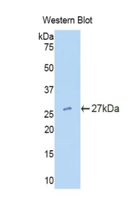 1 - Polyclonal Antibody to Tissue Factor Pathway Inhibitor 2 (TFPI2) AP74656