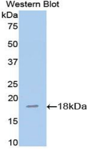 1 - Polyclonal Antibody to Annexin A2 (ANXA2) AP74609