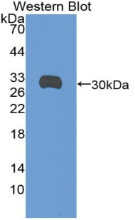 1 - Polyclonal Antibody to Syndecan 1 (SDC1) AP74724