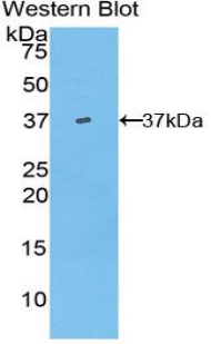 1 - Polyclonal Antibody to Hepcidin (Hepc) AP74610