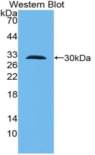 1 - Polyclonal Antibody to Toll Like Receptor 10 (TLR10) AP74725
