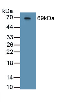 1 - Polyclonal Antibody to Hemojuvelin (HJV) AP74611