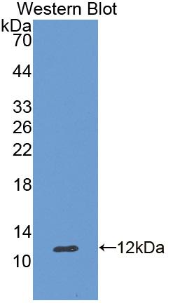 1 - Polyclonal Antibody to Apolipoprotein C2 (APOC2) AP74756