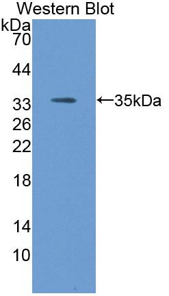 1 - Polyclonal Antibody to Apolipoprotein C2 (APOC2) AP74760