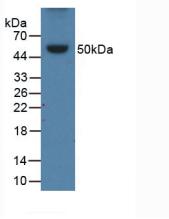1 - Polyclonal Antibody to Apolipoprotein B (APOB) AP74612