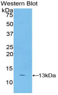 1 - Polyclonal Antibody to S100 Calcium Binding Protein A4 (S100A4) AP74640