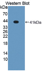 1 - Polyclonal Antibody to Liver X Receptor Alpha (LXRa) AP74743