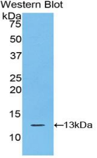 1 - Polyclonal Antibody to S100 Calcium Binding Protein A10 (S100A10) AP74629