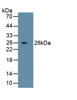 1 - Polyclonal Antibody to Ki-67 Protein (Ki-67) AP74613