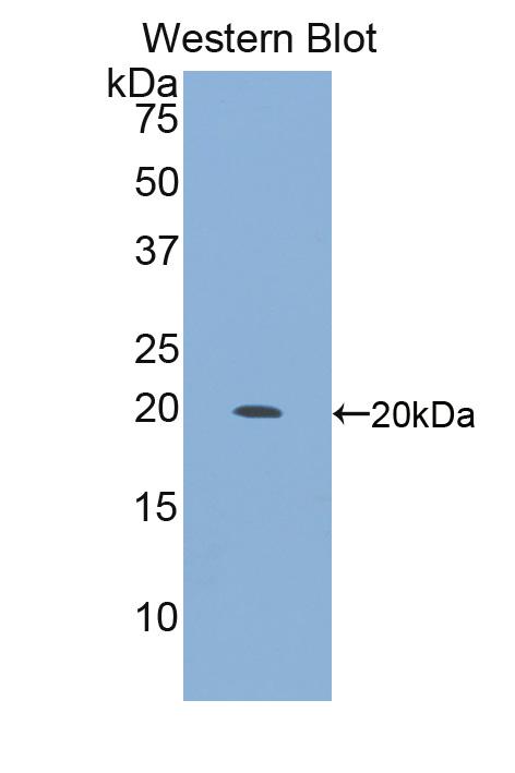 1 - Polyclonal Antibody to Integrin Alpha 10 (ITGa10) AP74677