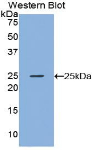 1 - Polyclonal Antibody to Noggin (NOG) AP74641