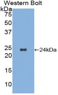 1 - Polyclonal Antibody to Noggin (NOG) AP74642