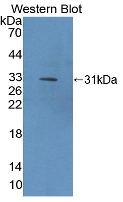 1 - Polyclonal Antibody to Collagen Type IX Alpha 1 (COL9a1) AP74615