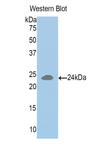 1 - Polyclonal Antibody to HLA Class II Histocompatibility Antigen, DR Alpha Chain (HLA-DRA) AP74679