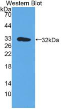 1 - Polyclonal Antibody to HLA Class II Histocompatibility Antigen, DR Alpha Chain (HLA-DRA) AP74680