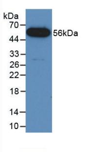 1 - Polyclonal Antibody to Fusion (FUS) AP74616