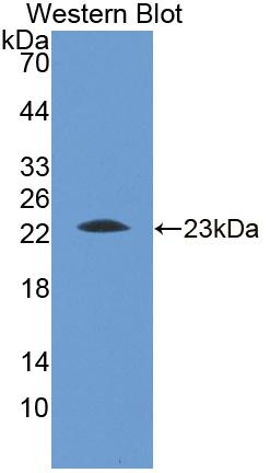 1 - Polyclonal Antibody to Apolipoprotein M (APOM) AP74757