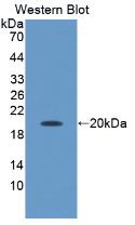 1 - Polyclonal Antibody to Apolipoprotein M (APOM) AP74651