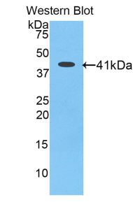 1 - Polyclonal Antibody to Angiotensin III (AngIII) AP74657