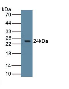 1 - Polyclonal Antibody to Aromatase (ARO) AP74617