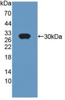 1 - Polyclonal Antibody to Cysteine Rich Secretory Protein 1 (CRISP1) AP74766