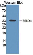 1 - Polyclonal Antibody to Keratocan (KERA) AP74753