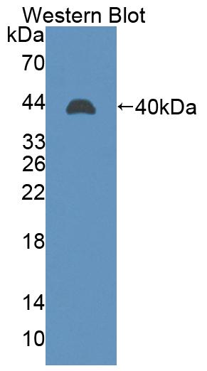 1 - Polyclonal Antibody to Lens Intrinsic Membrane Protein 2 (LIM2) AP74768