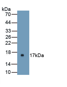 1 - Polyclonal Antibody to Uroplakin 1A (UPK1A) AP74763