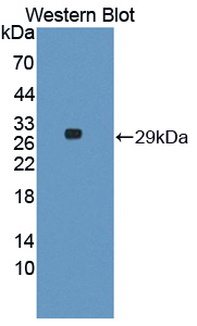 1 - Polyclonal Antibody to Vanin 1 (VNN1) AP74742