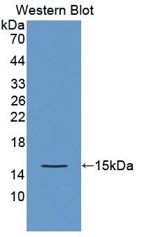 1 - Polyclonal Antibody to Otoraplin (OTOR) AP74770